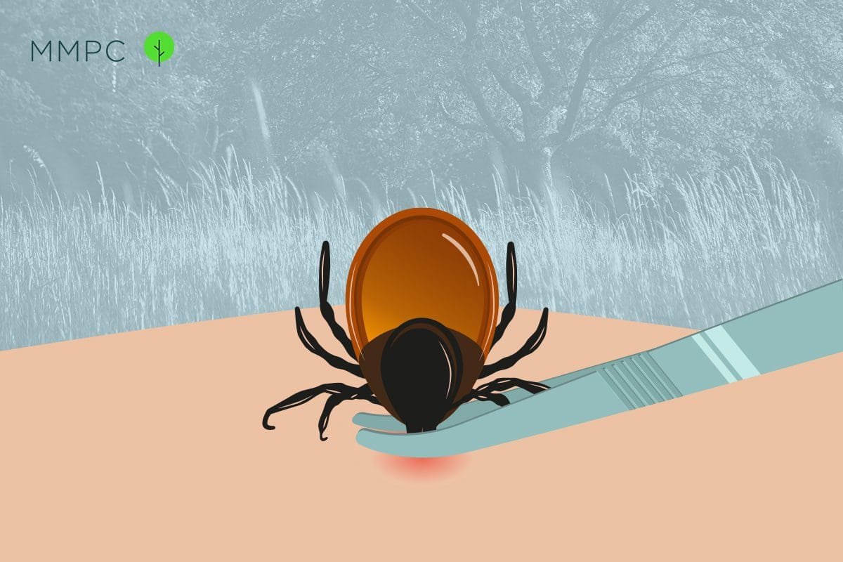 How to Remove a Tick